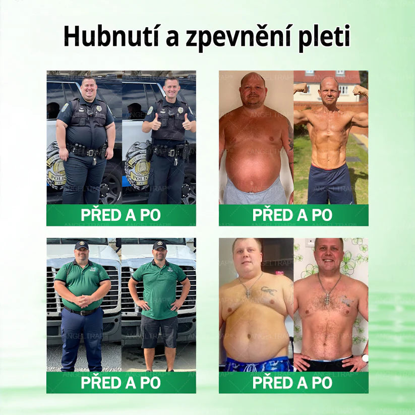 👍🇨🇿Oficiální prodejna | 🧑‍⚕️ANGELTRAP® 𝐌𝐨𝐫𝐢𝐧𝐠𝐚 × 𝐁𝐞𝐫𝐛𝐞𝐫𝐲𝐧𝐚 × 𝐀𝐌𝐏𝐊 𝟏𝟎 v 1 – Zeštíhlující nano mikrojihlový náplast 🇨🇿 Jen 1× denně ✅ Viditelné změny za 7 dní – na obezitu, kardiovaskulární zdraví, diabetes a kloubní problémy