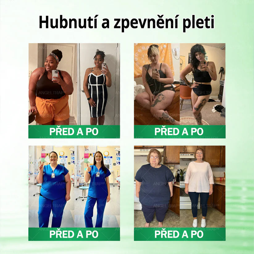 👍🇨🇿Oficiální prodejna | 🧑‍⚕️ANGELTRAP® 𝐌𝐨𝐫𝐢𝐧𝐠𝐚 × 𝐁𝐞𝐫𝐛𝐞𝐫𝐲𝐧𝐚 × 𝐀𝐌𝐏𝐊 𝟏𝟎 v 1 – Zeštíhlující nano mikrojihlový náplast 🇨🇿 Jen 1× denně ✅ Viditelné změny za 7 dní – na obezitu, kardiovaskulární zdraví, diabetes a kloubní problémy