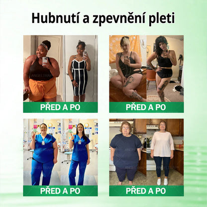 👍🇨🇿Oficiální prodejna | 🧑‍⚕️ANGELTRAP® 𝐌𝐨𝐫𝐢𝐧𝐠𝐚 × 𝐁𝐞𝐫𝐛𝐞𝐫𝐲𝐧𝐚 × 𝐀𝐌𝐏𝐊 𝟏𝟎 v 1 – Zeštíhlující nano mikrojihlový náplast 🇨🇿 Jen 1× denně ✅ Viditelné změny za 7 dní – na obezitu, kardiovaskulární zdraví, diabetes a kloubní problémy