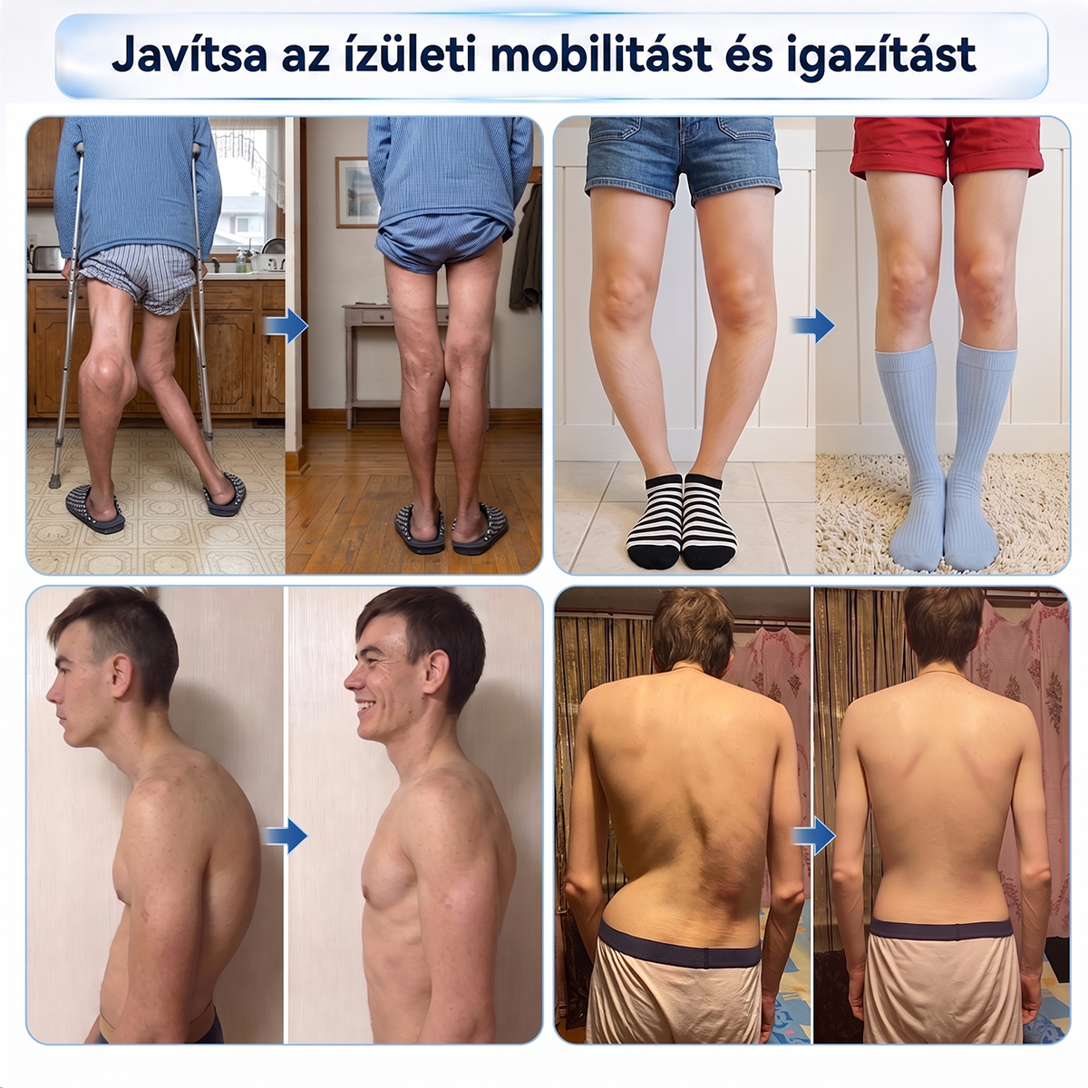 ✅✅𝗛𝗜𝗩𝗔𝗧𝗔𝗟𝗢𝗦 𝗪𝗘𝗕Á𝗥𝗨𝗛Á𝗭 | 𝑫𝑹.𝑯𝑶𝑵𝑶𝑹® 𝟎,𝟎𝟓 𝒎𝒎-𝐞𝐬 𝗠𝗶𝗸𝗿𝗼𝘁ű𝘀 𝗚𝗬𝗢𝗥𝗦 𝗛𝗔𝗧Á𝗦Ú Í𝐳ü𝐥𝐞𝐭- é𝐬 𝐂𝐬𝐨𝐧𝐭𝐟á𝐣𝐝𝐚𝐥𝐨𝐦-𝐞𝐧𝐲𝐡í𝐭ő 𝑹𝒐𝒍𝒍-𝗢𝗻 🦴