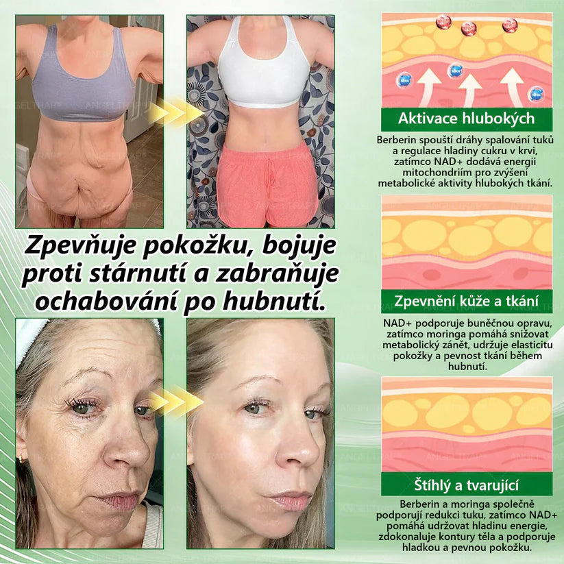 👍🇨🇿Oficiální prodejna | 🧑‍⚕️ANGELTRAP® 𝐌𝐨𝐫𝐢𝐧𝐠𝐚 × 𝐁𝐞𝐫𝐛𝐞𝐫𝐲𝐧𝐚 × 𝐀𝐌𝐏𝐊 𝟏𝟎 v 1 – Zeštíhlující nano mikrojihlový náplast 🇨🇿 Jen 1× denně ✅ Viditelné změny za 7 dní – na obezitu, kardiovaskulární zdraví, diabetes a kloubní problémy